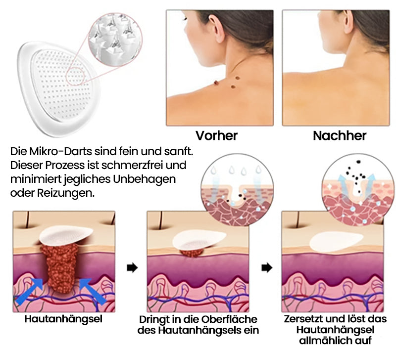 ✨ KUBOZN® MicroDarts Hautanhängsel-Pflaster – Fun Shapes Edition für sanfte Pflege