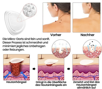 ✨ KUBOZN® MicroDarts Hautanhängsel-Pflaster – Fun Shapes Edition für sanfte Pflege