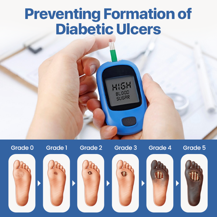 KUBOZN® VitaGluco Diabetes-Behandlungssalbe🌿 Dermatologisch getestet & empfohlen (offer)